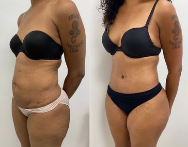 "Unleash Your Confidence with Youthful Radiance"